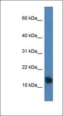 Anti-PTHLH antibody produced in rabbit affinity isolated antibody