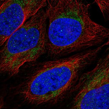 Anti-Acod1 Antibody Produced In Rabbit Prestige Antibodies&#174; Powered by Atlas Antibodies, affinity isolated antibody, buffered aqueous glycerol solution