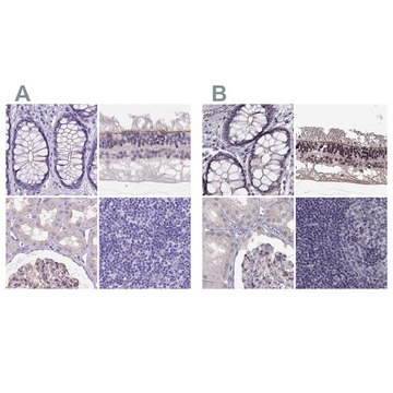 Anti-MPP5 antibody produced in rabbit Prestige Antibodies&#174; Powered by Atlas Antibodies, affinity isolated antibody