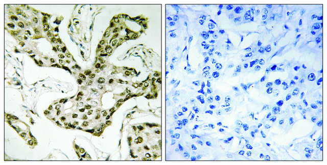 Anti-TOP2A antibody produced in rabbit affinity isolated antibody