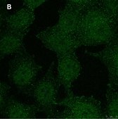 Anti-phospho-Stat1-Tyr701 Antibody, clone 1F23 ZooMAb® Rabbit Monoclonal recombinant, expressed in HEK 293 cells