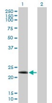 Anti-DYDC2 antibody produced in rabbit purified immunoglobulin, buffered aqueous solution