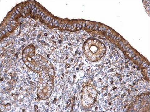 Anti-PLS3 antibody produced in rabbit affinity isolated antibody, buffered aqueous solution