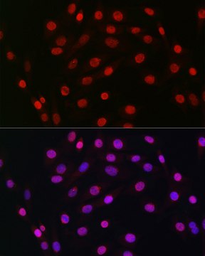 Anti-HDGF Antibody, clone 5U7A7, Rabbit Monoclonal