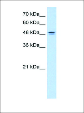 Anti-DHODH (AB1) antibody produced in rabbit affinity isolated antibody