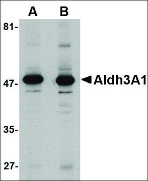 Anti-ALDH3A1 antibody produced in rabbit affinity isolated antibody, buffered aqueous solution