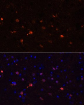 Anti-S100B antibody produced in rabbit