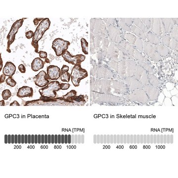 Anti-GPC3 antibody produced in mouse Prestige Antibodies&#174; Powered by Atlas Antibodies, clone CL12711, purified by using Protein A, buffered aqueous glycerol solution