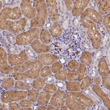 Anti-OSGEP antibody produced in rabbit Prestige Antibodies&#174; Powered by Atlas Antibodies, affinity isolated antibody, buffered aqueous glycerol solution