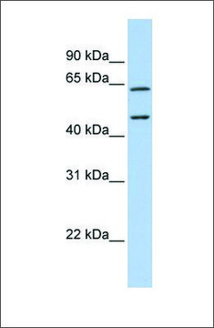 Anti-CECR1 antibody produced in rabbit affinity isolated antibody