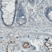 Monoclonal Anti-APOA4 antibody produced in mouse Prestige Antibodies® Powered by Atlas Antibodies, clone CL0468, purified immunoglobulin, buffered aqueous glycerol solution
