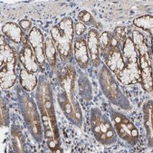 Anti-CCDC25 antibody produced in rabbit Prestige Antibodies® Powered by Atlas Antibodies, affinity isolated antibody, buffered aqueous glycerol solution