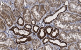 Anti-DR5/CD262 Antibody, clone 1B19 ZooMAb® Rabbit Monoclonal recombinant, expressed in HEK 293 cells