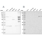 Anti-PKP1 antibody produced in rabbit Prestige Antibodies&#174; Powered by Atlas Antibodies, affinity isolated antibody, buffered aqueous glycerol solution, ab1