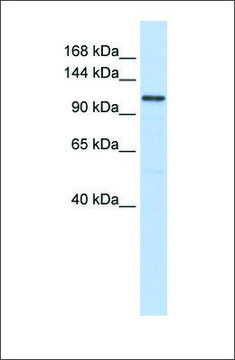 Anti-ADCY8 antibody produced in rabbit affinity isolated antibody