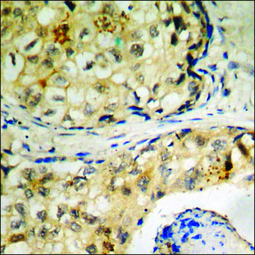 Anti-phospho-Tau (pThr205) antibody produced in rabbit affinity isolated antibody