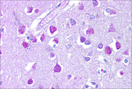 Anti-ETV1 antibody produced in rabbit affinity isolated antibody