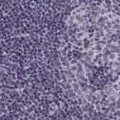 Anti-MPP5 antibody produced in rabbit Prestige Antibodies® Powered by Atlas Antibodies, affinity isolated antibody, buffered aqueous glycerol solution
