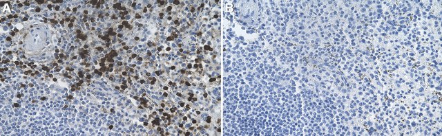 Anti-FUT4/CD15 Antibody, clone 1H4 ZooMAb&#174; Rabbit Monoclonal recombinant, expressed in HEK 293 cells