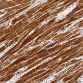 Monoclonal Anti-RHOT1 antibody produced in mouse Prestige Antibodies&#174; Powered by Atlas Antibodies, clone CL1083, purified immunoglobulin, buffered aqueous glycerol solution