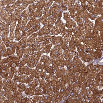 Anti-PHKA2 antibody produced in rabbit Prestige Antibodies&#174; Powered by Atlas Antibodies, affinity isolated antibody, buffered aqueous glycerol solution