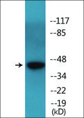 Anti-phospho-p53 (pSer15) antibody produced in rabbit affinity isolated antibody