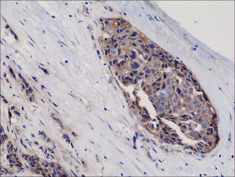 Anti-beta-Catenin 1 antibody, Rabbit monoclonal recombinant, expressed in HEK 293 cells, clone RM276, purified immunoglobulin