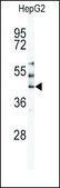 Anti-MST3 (C-term) antibody produced in rabbit IgG fraction of antiserum, buffered aqueous solution