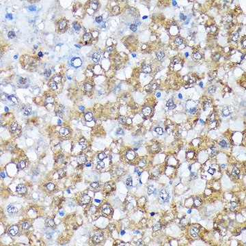 Anti-Casein Kinase 1 alpha (CSNK1A1) Antibody, clone 9O4L9, Rabbit Monoclonal