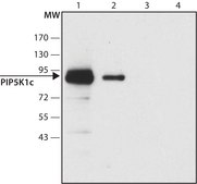 Anti-PIP5K1C (C-terminal) antibody produced in rabbit ~1.5 mg/mL, affinity isolated antibody, buffered aqueous solution
