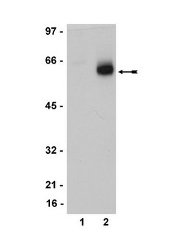 抗雌激素受体&#946;抗体，克隆68-4，兔单克隆 clone 68-4, Upstate&#174;, from rabbit