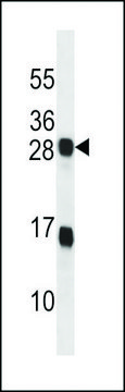 ANTI-KDELR2(C-TERMINAL) antibody produced in rabbit affinity isolated antibody, buffered aqueous solution