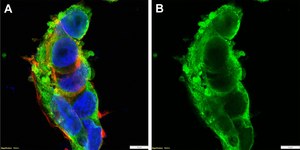 Anti-Lin28A Antibody, clone 1E3 ZooMAb® Rabbit Monoclonal recombinant, expressed in HEK 293 cells