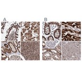 Anti-PDHX antibody produced in rabbit Prestige Antibodies® Powered by Atlas Antibodies, affinity isolated antibody, buffered aqueous glycerol solution