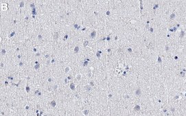 Anti-Histone H2B Antibody, clone 1L5 ZooMAb® Rabbit Monoclonal recombinant, expressed in HEK 293 cells
