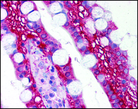 Anti-TLR1 (AB2) antibody produced in rabbit IgG fraction of antiserum, buffered aqueous solution