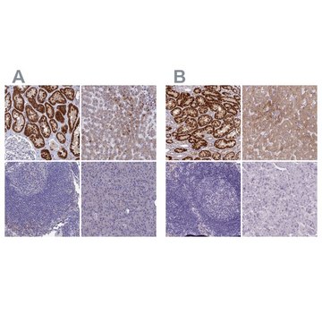 Anti-AK4 antibody produced in rabbit Prestige Antibodies&#174; Powered by Atlas Antibodies, affinity isolated antibody, buffered aqueous glycerol solution