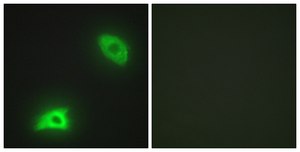 Anti-DUSP6 antibody produced in rabbit affinity isolated antibody
