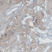 Anti-NOX4 antibody produced in rabbit Prestige Antibodies® Powered by Atlas Antibodies, affinity isolated antibody, buffered aqueous glycerol solution