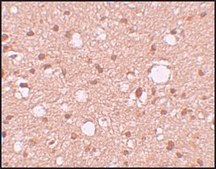 Anti-APBA2 antibody produced in rabbit affinity isolated antibody, buffered aqueous solution