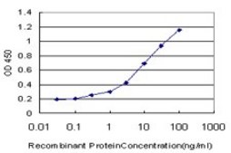 ANTI-IRAK3 antibody produced in mouse clone 1G11, purified immunoglobulin, buffered aqueous solution