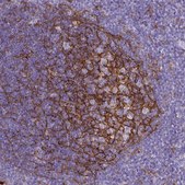 Monoclonal Anti-ITGAM antibody produced in mouse Prestige Antibodies® Powered by Atlas Antibodies, clone CL1719, purified immunoglobulin, buffered aqueous glycerol solution