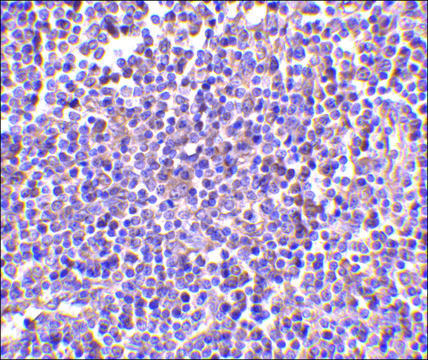 Anti-AIM (ab2) antibody produced in rabbit affinity isolated antibody, buffered aqueous solution