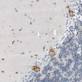 Anti-B4GALNT1 antibody produced in rabbit Ab1, Prestige Antibodies® Powered by Atlas Antibodies, affinity isolated antibody, buffered aqueous glycerol solution