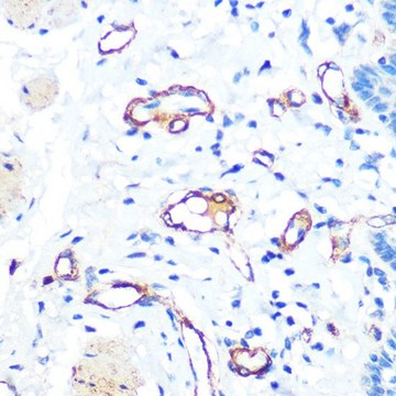 Anti-VWF antibody produced in rabbit