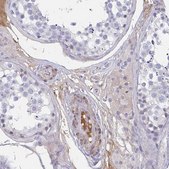 Anti-TNFAIP6 antibody produced in rabbit Prestige Antibodies® Powered by Atlas Antibodies, affinity isolated antibody, buffered aqueous glycerol solution