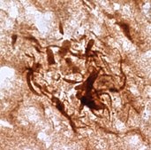 Anti-RTN3 (R458) from rabbit