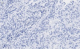 Anti-MICB Antibody, clone 2K9 ZooMAb® Rabbit Monoclonal recombinant, expressed in HEK 293 cells