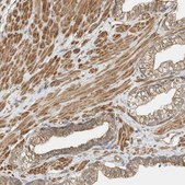 Anti-OFD1 antibody produced in rabbit Prestige Antibodies® Powered by Atlas Antibodies, affinity isolated antibody, buffered aqueous glycerol solution