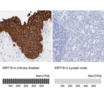 Anti-KRT19 antibody produced in rabbit Prestige Antibodies&#174; Powered by Atlas Antibodies, affinity isolated antibody, buffered aqueous glycerol solution